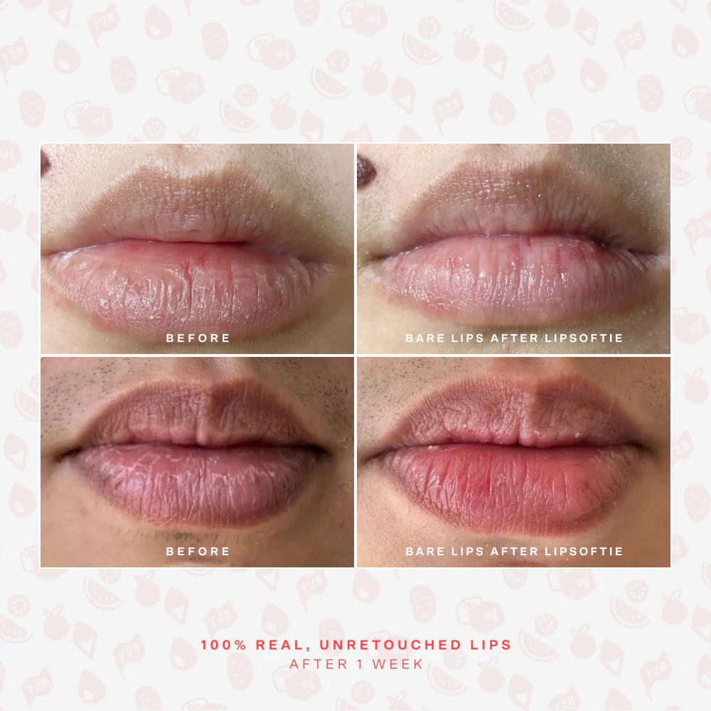 LipSoftie® Lip Treatment - Image 53