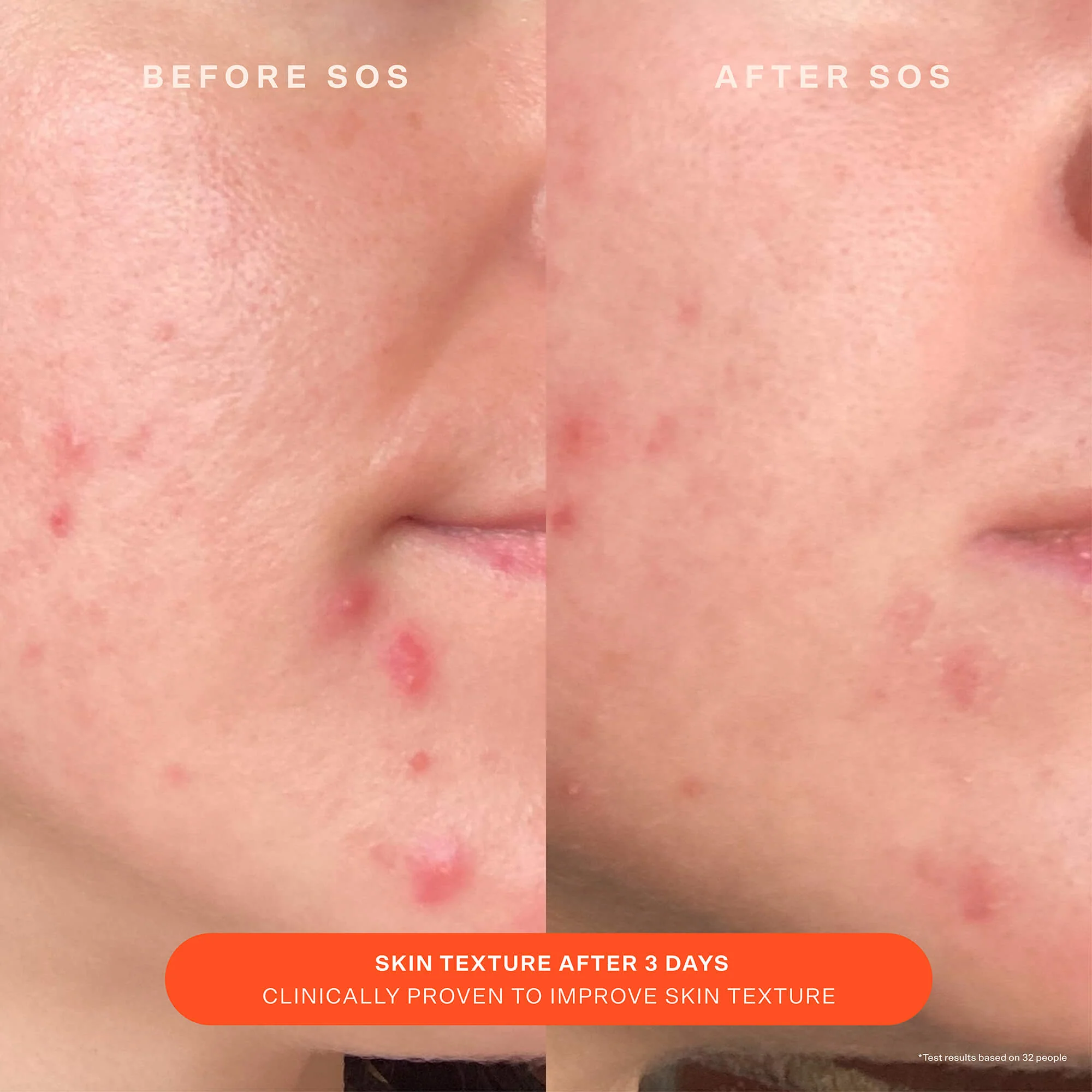 SOS Recovery Cream - Image 5