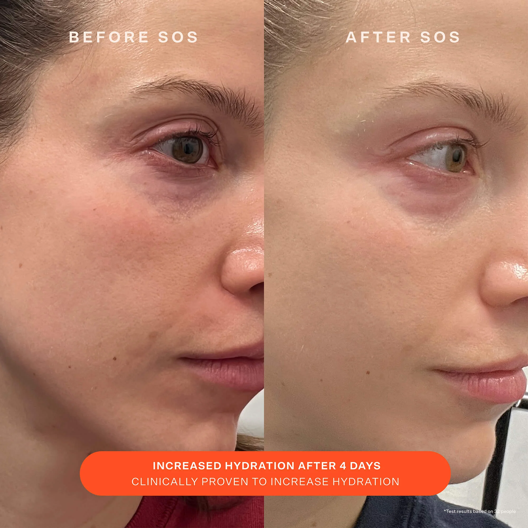 SOS Recovery Cream - Image 6