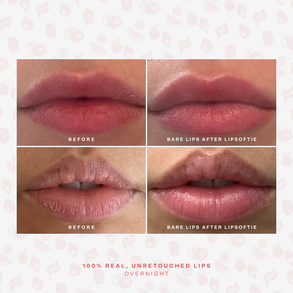 SOS LipSoftie® Lip Treatment - Image 5