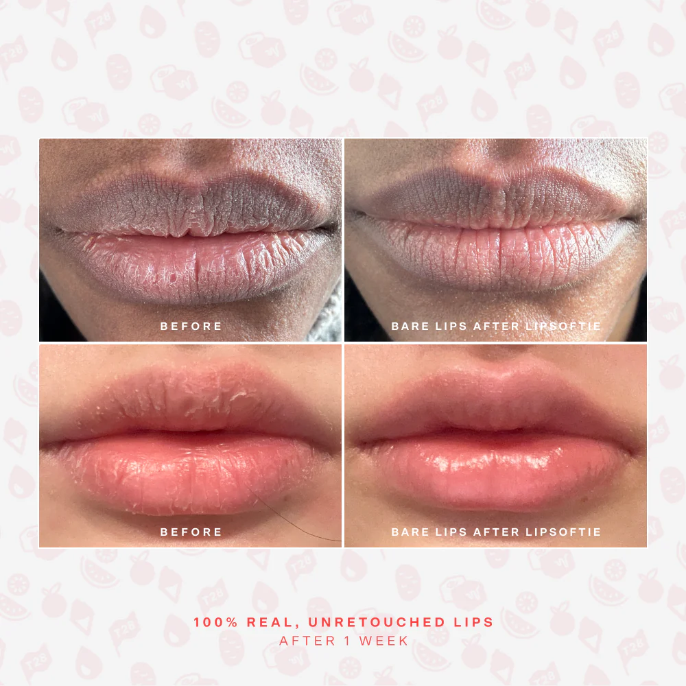 SOS LipSoftie® Lip Treatment - Image 6